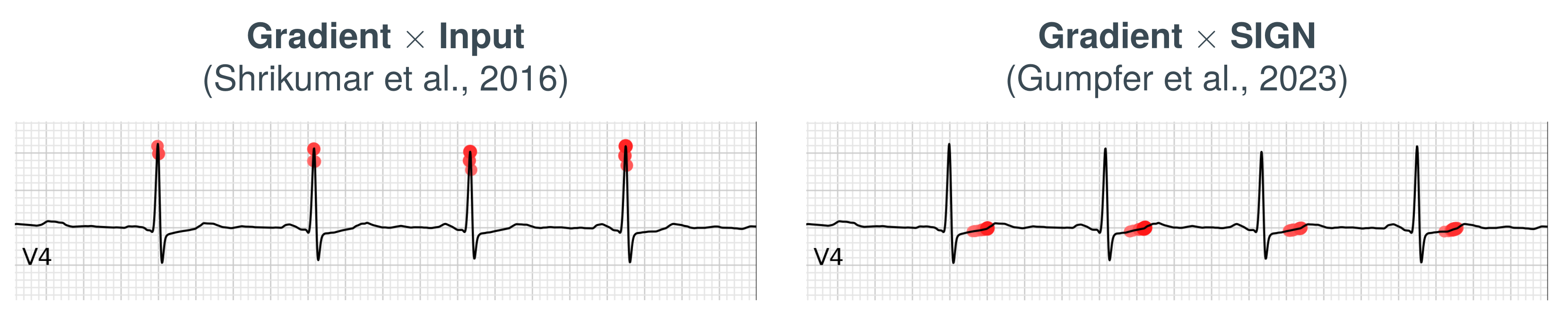 sign_ecg.png